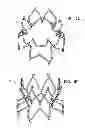 Fig. 06 - Stent fixation with reduced plastic deformation