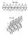 Fig. 08 - Stent fixation with reduced plastic deformation