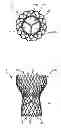 Fig. 01 - Transcatheter prosthetic heart valve delivery system and method with controlled expansion of prosthetic heart valve