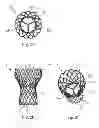 Fig. 05 - Transcatheter prosthetic heart valve delivery system and method with controlled expansion of prosthetic heart valve