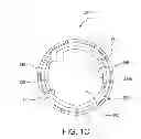 Fig. 04 - Planar zone in prosthetic heart valve leaflet