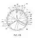 Fig. 05 - Planar zone in prosthetic heart valve leaflet
