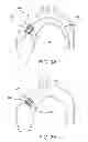 Fig. 07 - Planar zone in prosthetic heart valve leaflet