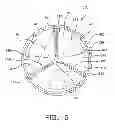 Fig. 09 - Planar zone in prosthetic heart valve leaflet