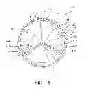 Fig. 10 - Planar zone in prosthetic heart valve leaflet
