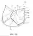 Fig. 04 - Truncated leaflet for prosthetic heart valves, preformed valve