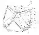 Fig. 01 - Vertical coaptation zone in a planar portion of prosthetic heart valve leaflet