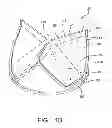Fig. 03 - Vertical coaptation zone in a planar portion of prosthetic heart valve leaflet