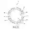 Fig. 04 - Vertical coaptation zone in a planar portion of prosthetic heart valve leaflet