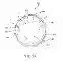 Fig. 08 - Prosthetic heart valve with leaflet shelving