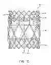 Fig. 03 - Geometric prosthetic heart valves