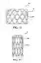 Fig. 05 - Geometric prosthetic heart valves