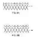 Fig. 12 - Geometric prosthetic heart valves