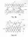 Fig. 14 - Geometric prosthetic heart valves