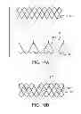 Fig. 17 - Geometric prosthetic heart valves