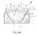 Fig. 18 - Geometric prosthetic heart valves