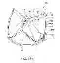 Fig. 19 - Geometric prosthetic heart valves