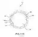 Fig. 20 - Geometric prosthetic heart valves