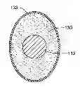 Fig. 01 - Epicardial clip