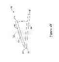Fig. 04 - Epicardial clip