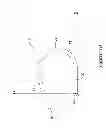 Fig. 06 - Epicardial clip