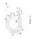 Fig. 08 - Epicardial clip