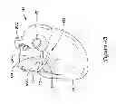 Fig. 13 - Epicardial clip