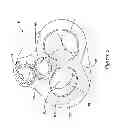 Fig. 14 - Epicardial clip