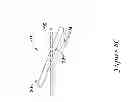 Fig. 17 - Epicardial clip