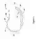 Fig. 18 - Epicardial clip