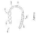 Fig. 19 - Epicardial clip