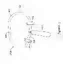 Fig. 22 - Epicardial clip