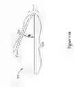 Fig. 27 - Epicardial clip