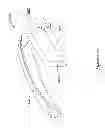 Fig. 32 - Epicardial clip