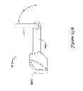 Fig. 33 - Epicardial clip