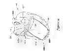 Fig. 46 - Epicardial clip