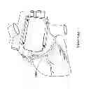 Fig. 58 - Epicardial clip
