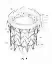 Fig. 02 - Vascular implant
