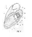 Fig. 04 - Vascular implant