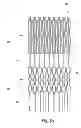 Fig. 07 - Vascular implant