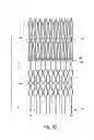 Fig. 09 - Vascular implant