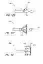 Fig. 16 - Vascular implant