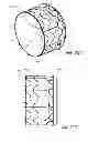 Fig. 41 - Vascular implant