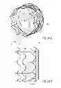 Fig. 43 - Vascular implant