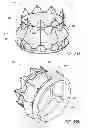 Fig. 44 - Vascular implant