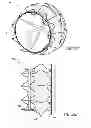 Fig. 45 - Vascular implant