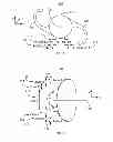 Fig. 02 - Method and system for providing an intraocular lens having an improved depth of field