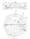 Fig. 04 - Method and system for providing an intraocular lens having an improved depth of field