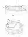 Fig. 07 - Capsule expander devices, systems, and methods for inhibiting capsular opacification and stabilizing the capsule