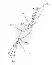 Fig. 01 - Seamless-vision, tilted intraocular lens